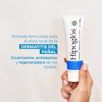 HIPOGLOS POMADA X 50 GR